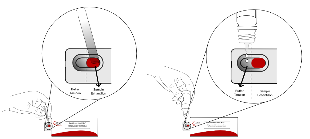 HAT Procedure
